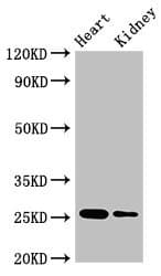 CSH2 / Placental Lactogen Antibody