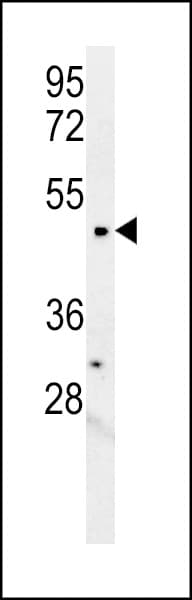 LCLAT1 Antibody (aa296-324)