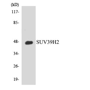 SUV39H2 Antibody (aa101-150)