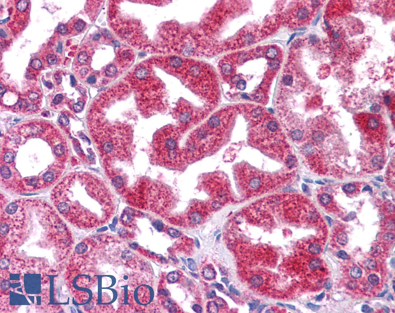 STAT3 Antibody (N-Terminus)