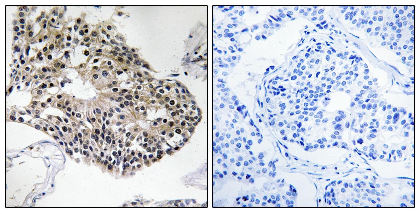 RPS25 / Ribosomal Protein S25 Antibody