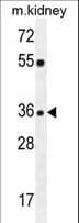 KLF14 / BTEB5 Antibody (aa254-283)