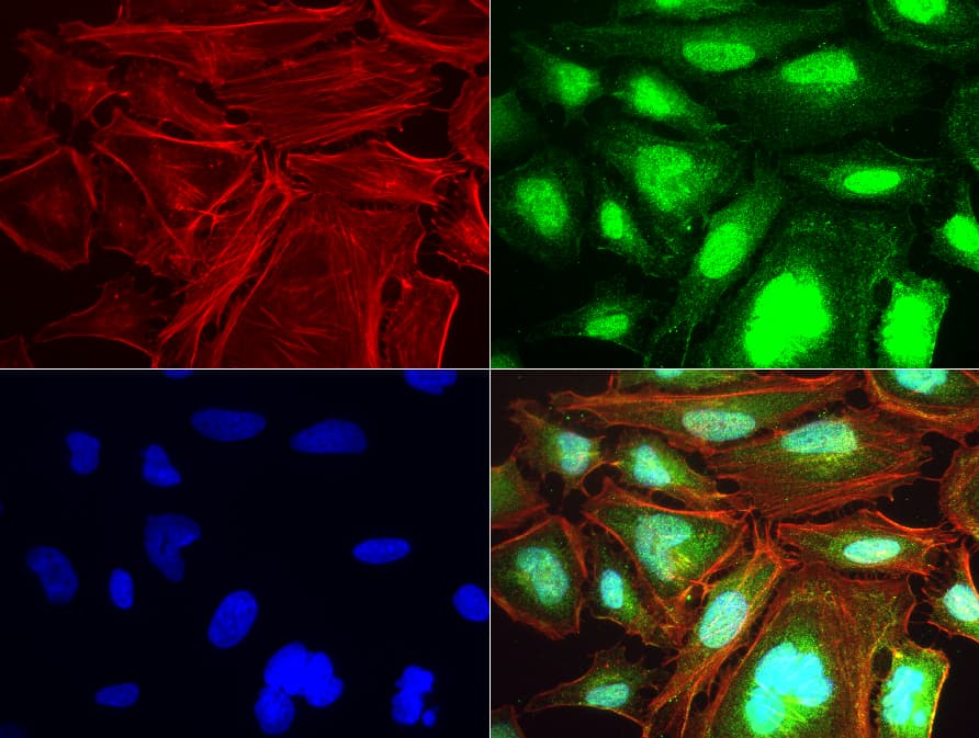 TNFRSF18 / GITR Antibody (aa26-162, clone UMAB203)