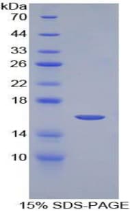 Mouse NRARP Protein (Recombinant His-T7)