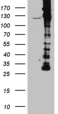 Monoclonal Mouse anti-Human DBN1 / Drebrin Antibody (clone OTI4B1, aa2-240, IHC, WB)