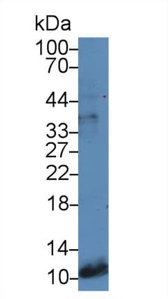 Gastrin Antibody