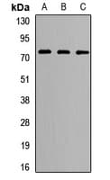 Polyclonal Rabbit anti-Human LRRC4 Antibody (WB)
