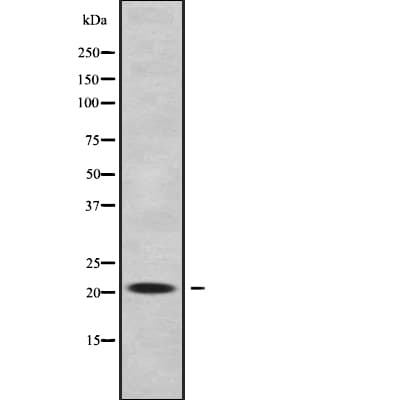 IFT22 / RABL5 Antibody