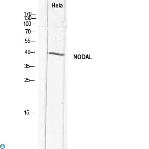 NODAL Antibody