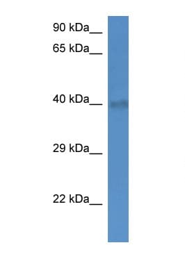 SLC25A27 / UCP4 Antibody (aa224-273)