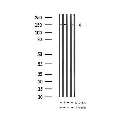 EGFR Antibody (phospho-Tyr1197)