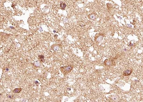 Polyclonal Rabbit anti-Human NTRK2 / TRKB Antibody (phospho-Tyr515, IHC, IF, WB)