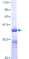 Human IQGAP2 Protein (Recombinant GST, N-terminus)