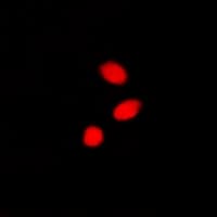 Polyclonal Rabbit anti-Human CBX4 Antibody (IF, WB)