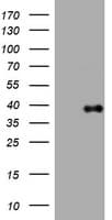 PIK3C2A Antibody (aa230-560, clone OTI2C2)