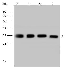 Polyclonal Rabbit anti-Human Rhodanese / TST Antibody (IHC, IF, WB)