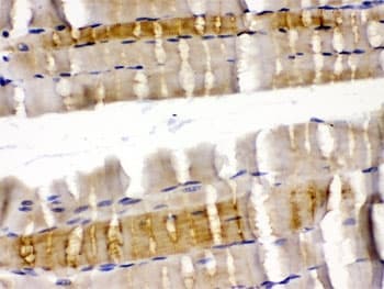 CFL2 / Cofilin 2 Antibody