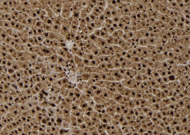 Polyclonal Rabbit anti-Human AGO3 / EIF2C3 Antibody (IHC, WB)