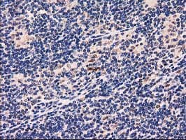 GRHPR / Glyoxylate Reductase Antibody (clone OTI2H4)