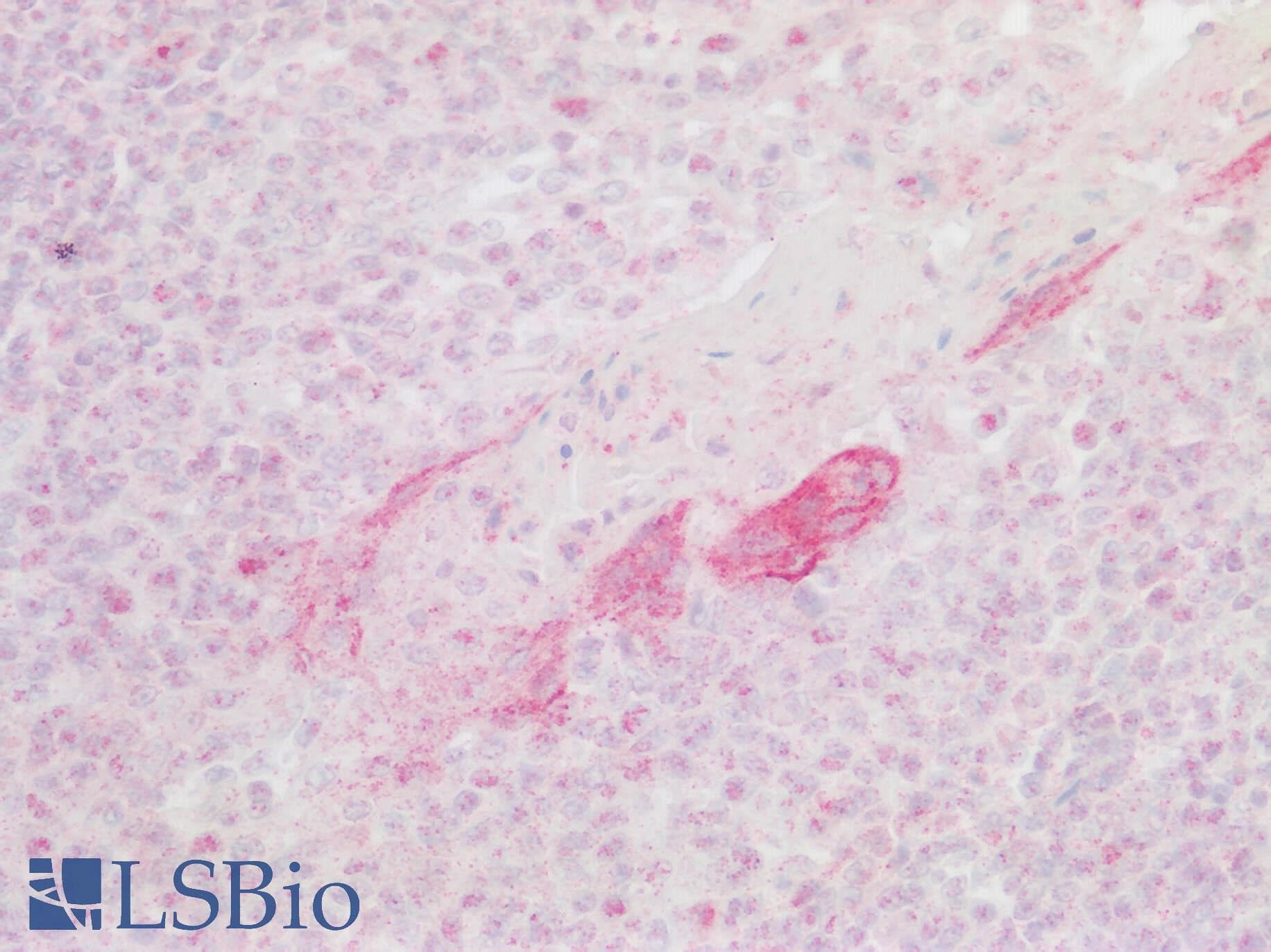 IHC-plus™ Polyclonal Rabbit anti-Human CXCR6 Antibody (Cytoplasmic Domain, IHC)