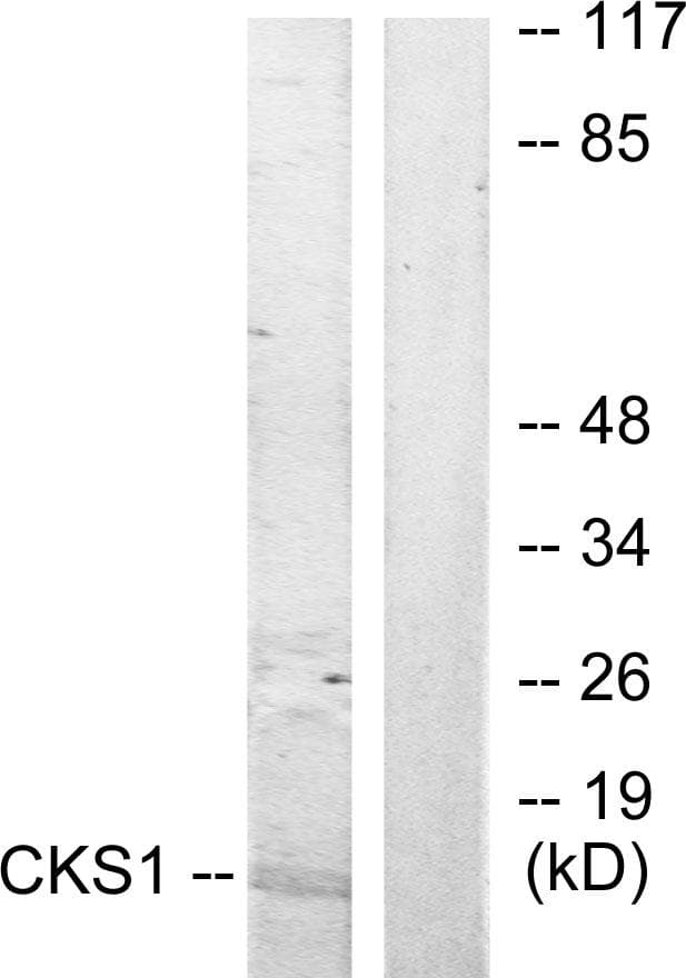 Polyclonal Rabbit anti-Human CKS1B / CKS1 Antibody (IF, WB)