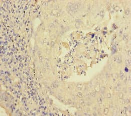 Polyclonal Rabbit anti-Human PEX16 Antibody (IHC)