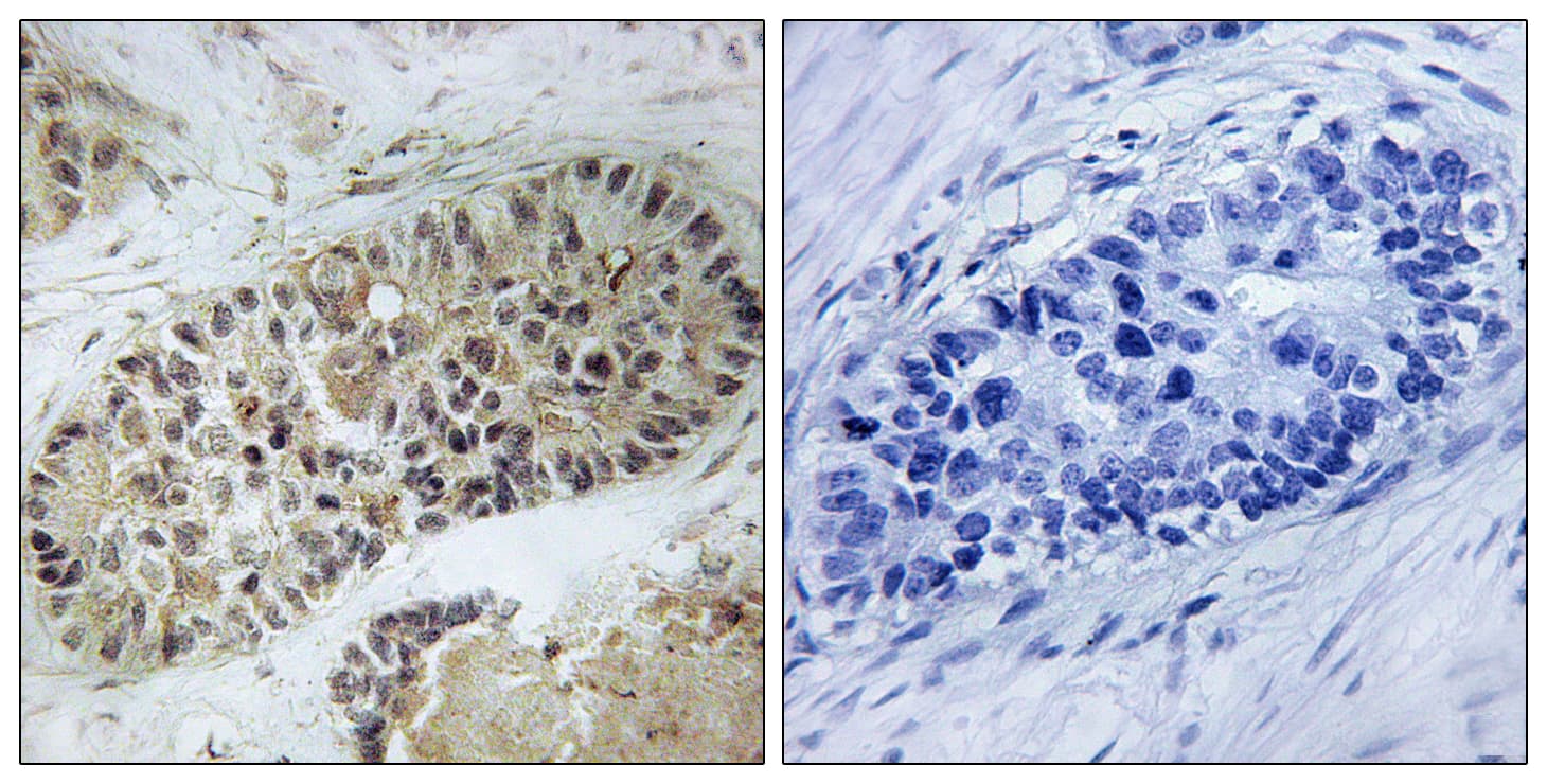 Polyclonal Rabbit anti-Human DCLRE1C / Artemis Antibody (phospho-Ser516, IHC, WB)