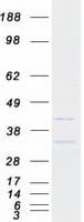 Human B3GNT9 Protein (Recombinant Myc-DDK (Flag))
