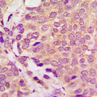 ULK3 Antibody (Internal)