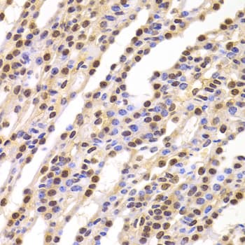 BUB3 Antibody