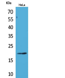 CD3D Antibody