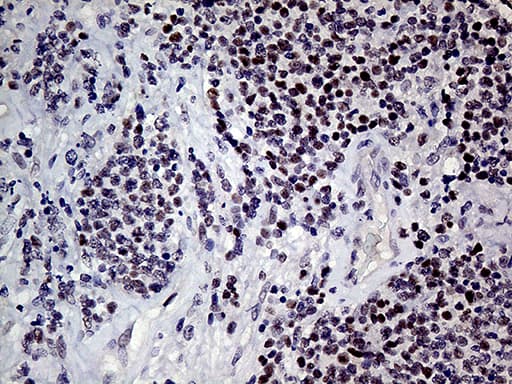 Monoclonal Mouse anti-Human MLH1 Antibody (clone OTI4H6, Carrier-free, aa299-527, IHC, WB)