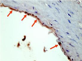 Polyclonal Rabbit Hemagglutinin / HA Tag Antibody (aa114-122, IHC, WB)
