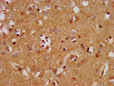 MAP1L / MAP1A Antibody