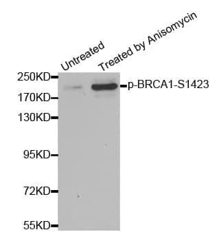 BRCA1 Antibody (phospho-Ser1423)