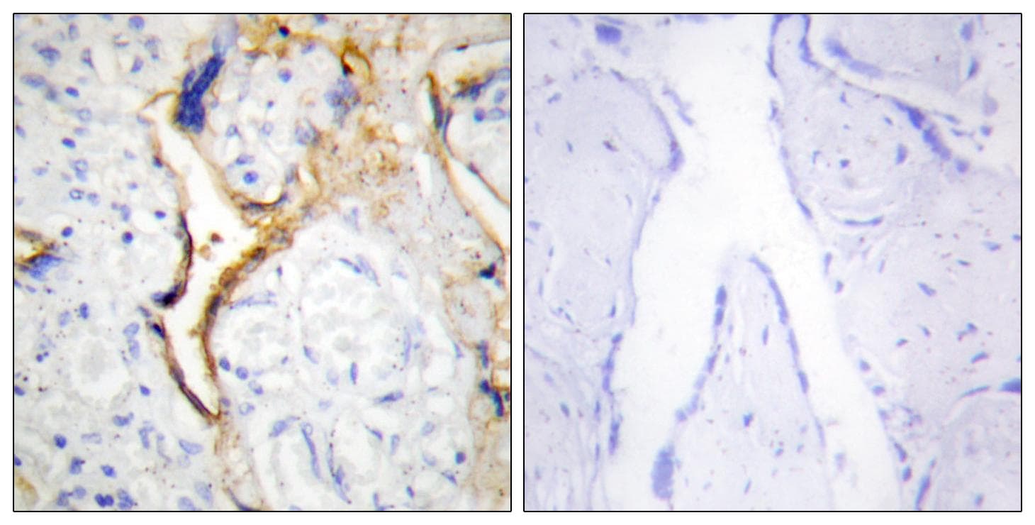 CSNK1E / CK1 Epsilon Antibody