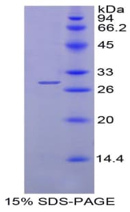 Mouse Alpha-Fetoprotein (Recombinant His-S)