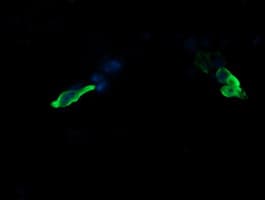 Monoclonal Mouse anti-Human MAP2K3 / MEK3 / MKK3 Antibody (clone OTI1H6, IHC, IF, WB)