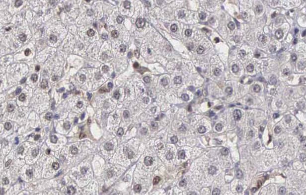 DNAJB1 / Hsp40 Antibody