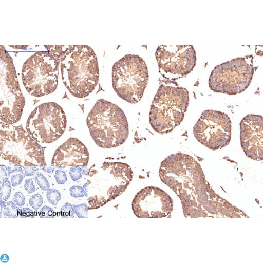 APG5 / ATG5 Antibody