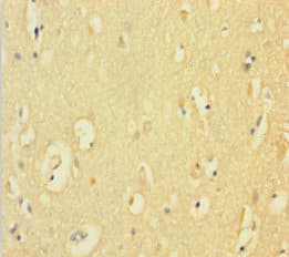CYBB / NOX2 / gp91phox Antibody (aa283-570)