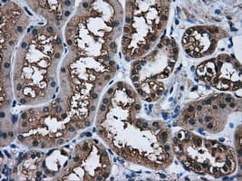 Monoclonal Mouse anti-Human AKR1A1 Antibody (clone OTI3C7, IHC, WB)