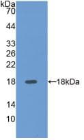 SELE / CD62E / E-selectin Antibody (aa108-238, Biotin)