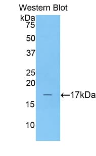 CPLX2 / Complexin 2 Antibody (aa2-134)