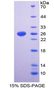Human GPV / CD42d Protein (Recombinant His-T7)