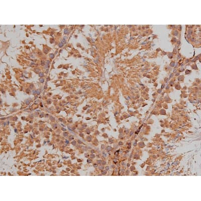 Polyclonal Rabbit anti-Human SP1 Antibody (phospho-Thr739, IHC, IF, WB)