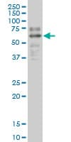 PathPlus™ Monoclonal Mouse anti-Human SOX9 Antibody (clone 3F11, IHC, IF, WB)