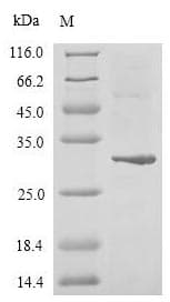 Human GLI2 Protein (Recombinant 6His, N-terminus)