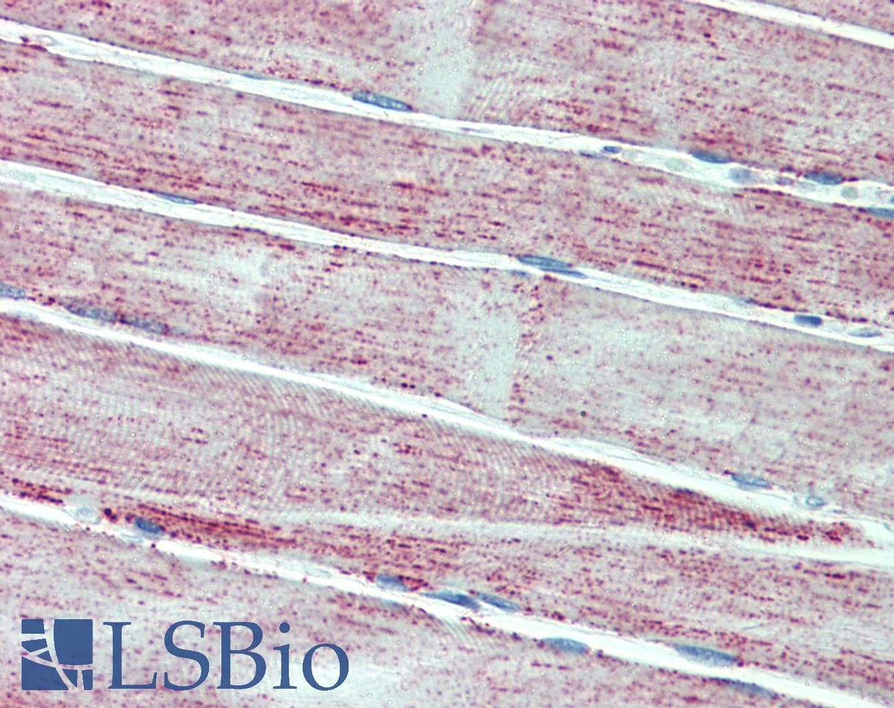 PathPlus™ SOD2 / Mn SOD Antibody (clone 37CT127.5.11.6)