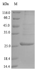 Mouse ARTS1 / ERAP1 Protein (Recombinant 10His, N-terminus + Myc, C-terminus)